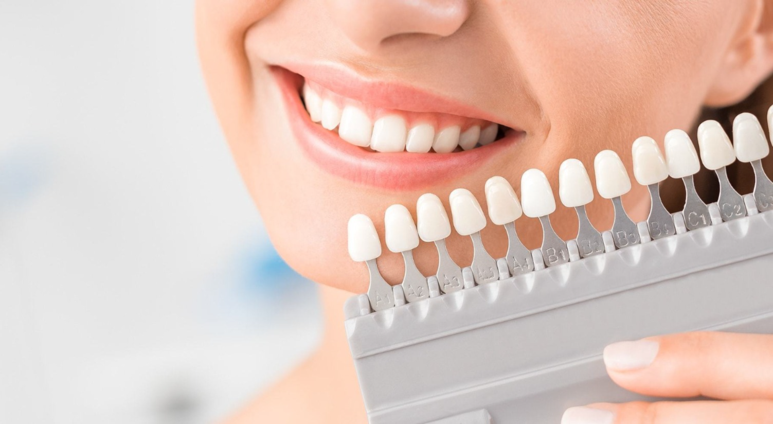 Facetas e Lente de Contato Dental