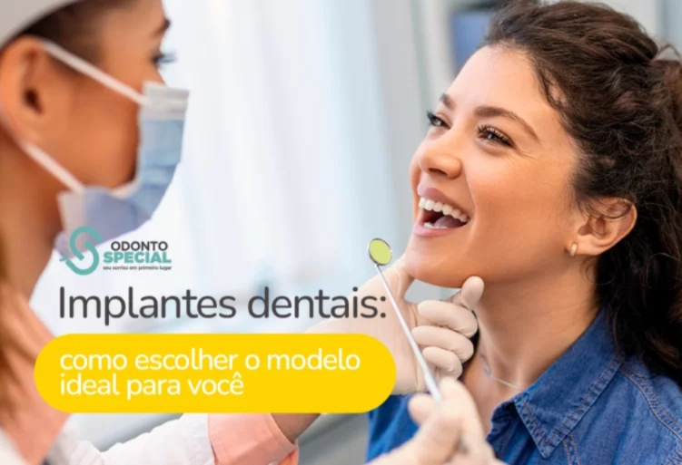 IMPLANTES DENTAIS: COMO ESCOLHER O MODELO IDEAL PARA VOCÊ